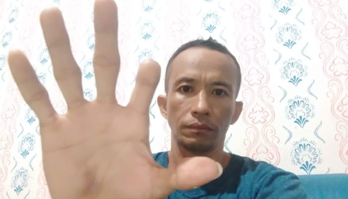 Seorang Karyawan PT Sasl And Sons Indonesia Cacat Akibat Kecelakaan Kerja, Kompensasi Tak Kunjung Cair